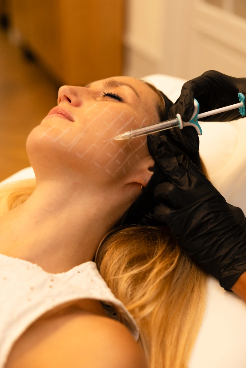 Skinbooster - Clinique Esthétique des Quinconces