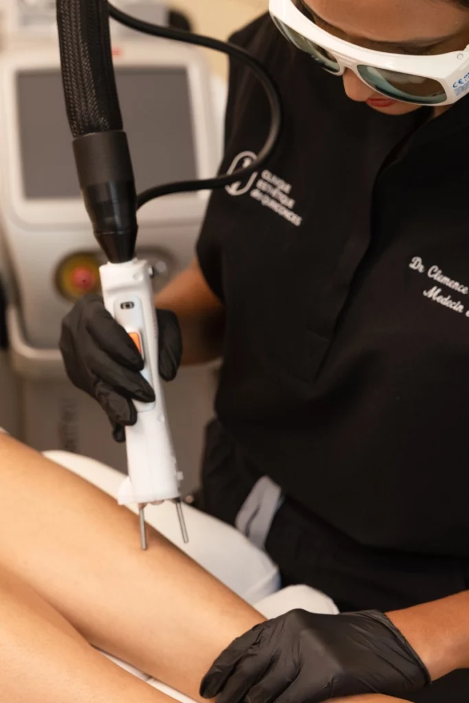 Laser médical - Clinique Esthétique des Quinconces