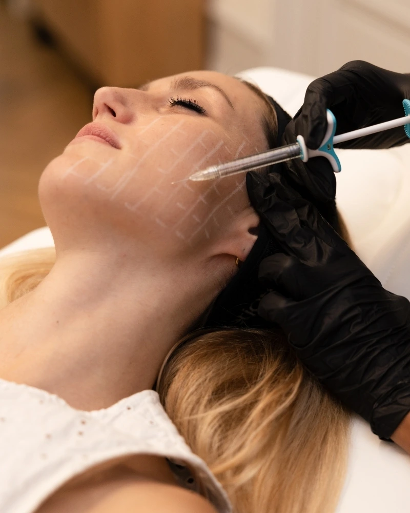 Skinbooster à Bordeaux