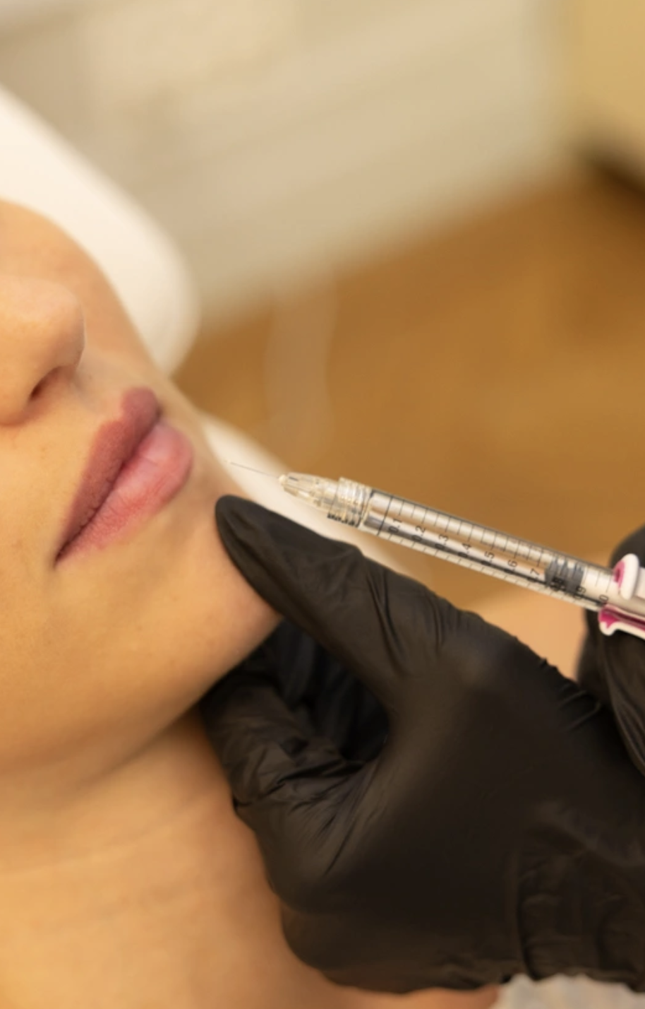 acide hyaluronique à Bordeaux